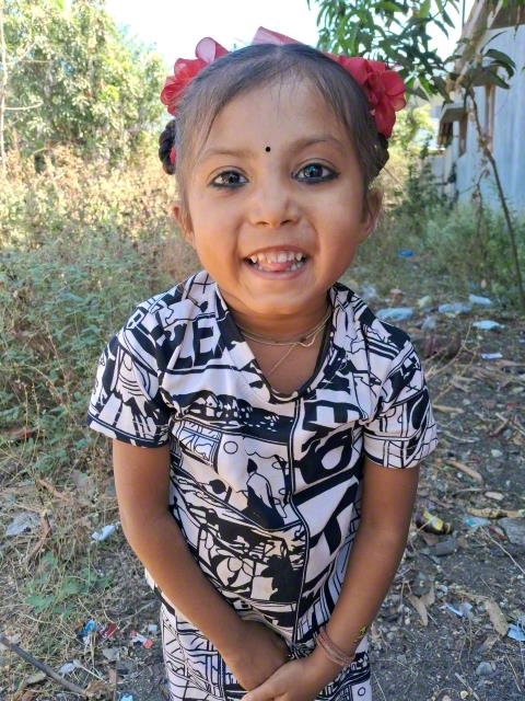 World Vision India